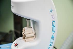 Regenera Activa Hair Loss Treatment Without Surgery
