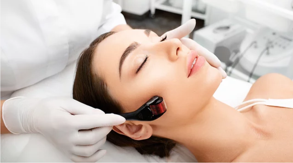 microneedling