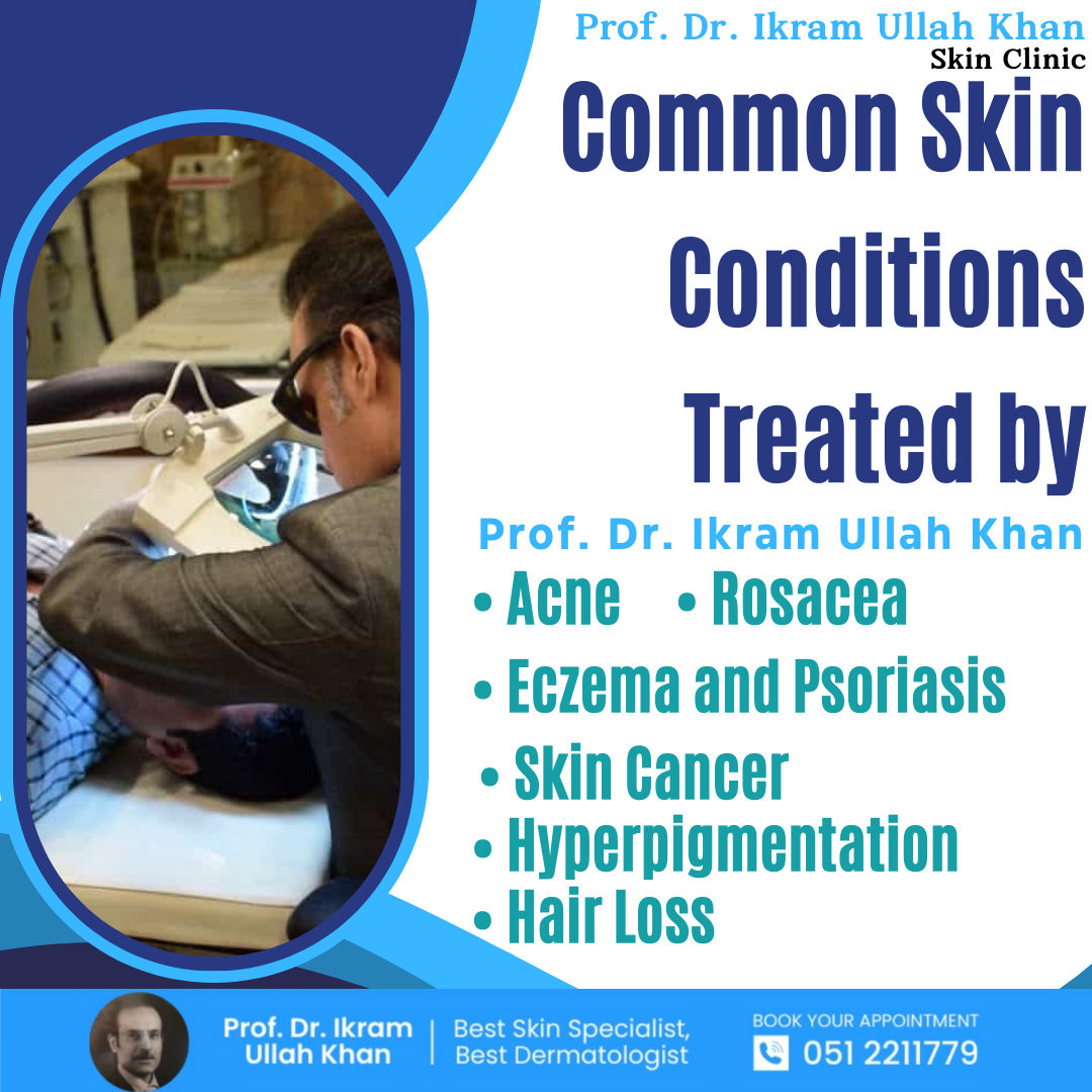 Common Skin Conditions Treated by Prof. Dr. Ikram Ullah Khan