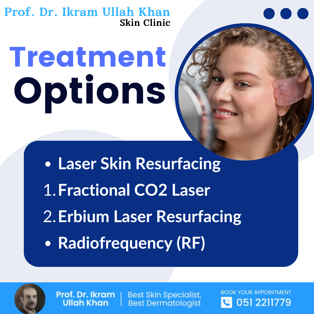 Treatment-Options-for-Acne-Scars