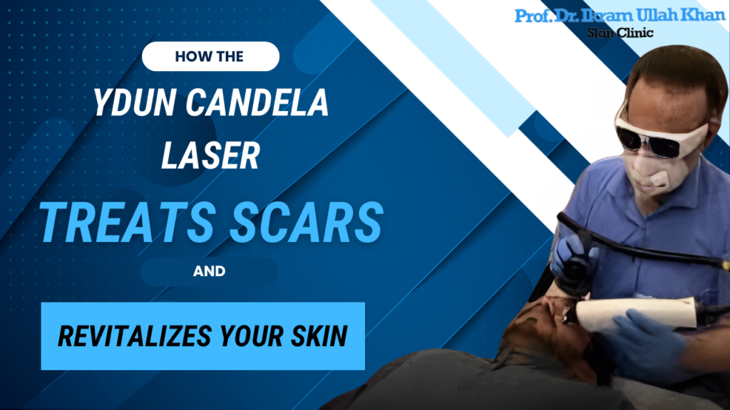 How the Ydun Candela Laser Treats Scars and Revitalizes Your Skin