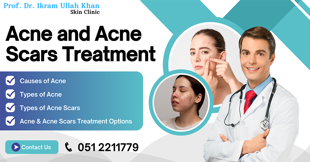 ance-and-ance-scars-treatment