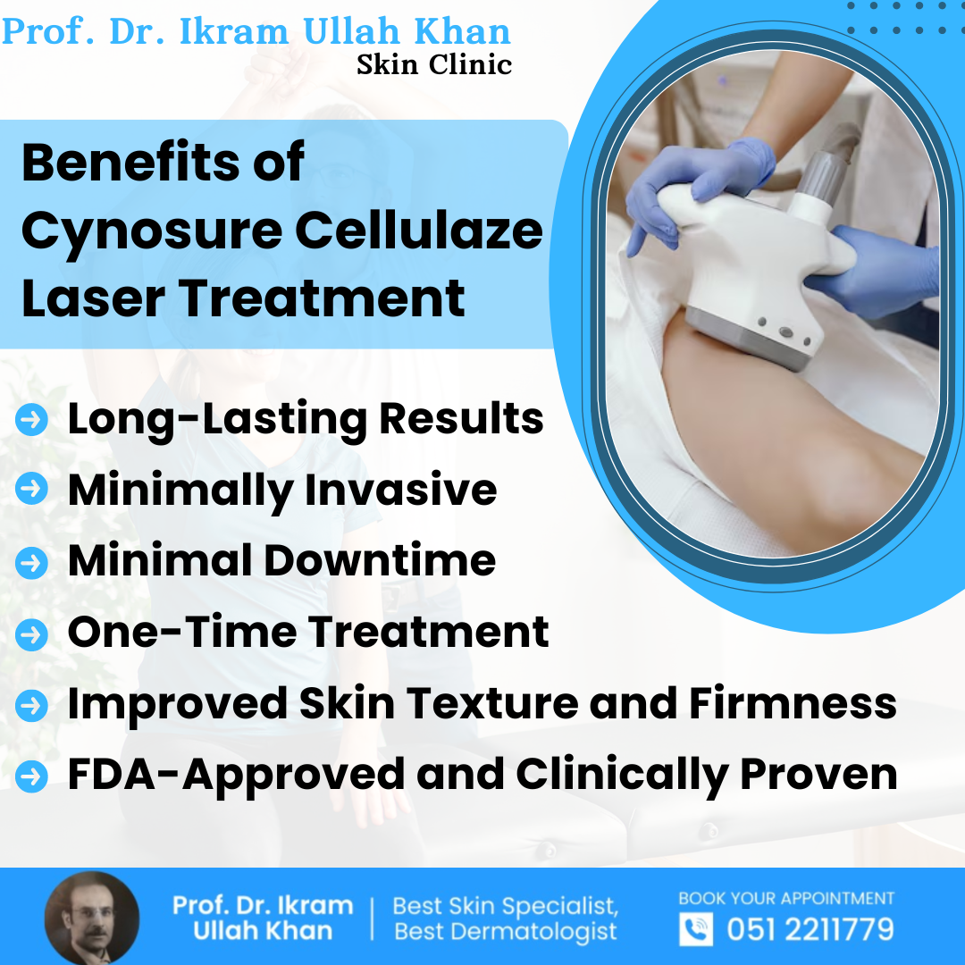 benefits-of-cynosure-cellulaze-laser-treatment