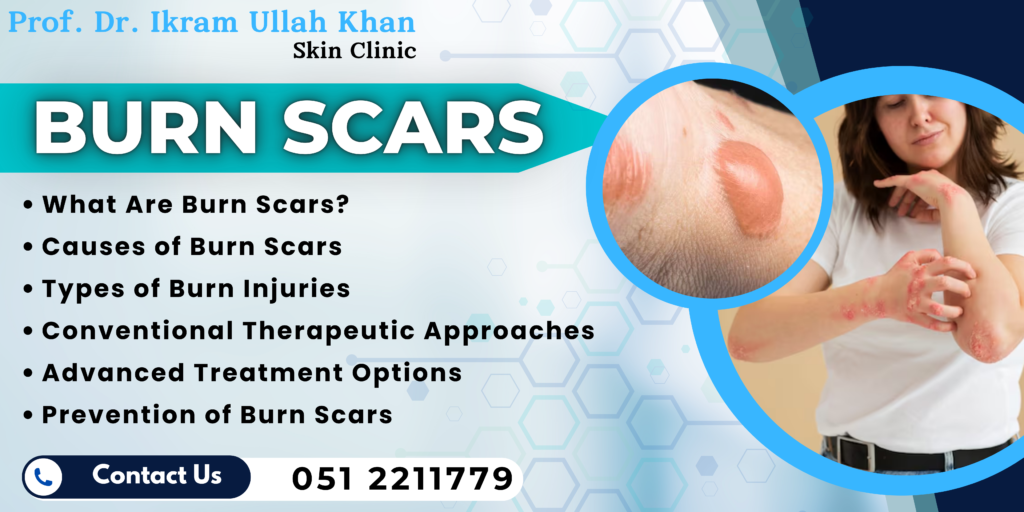 Burn Scars: Understanding Causes, Types and Advanced Solutions