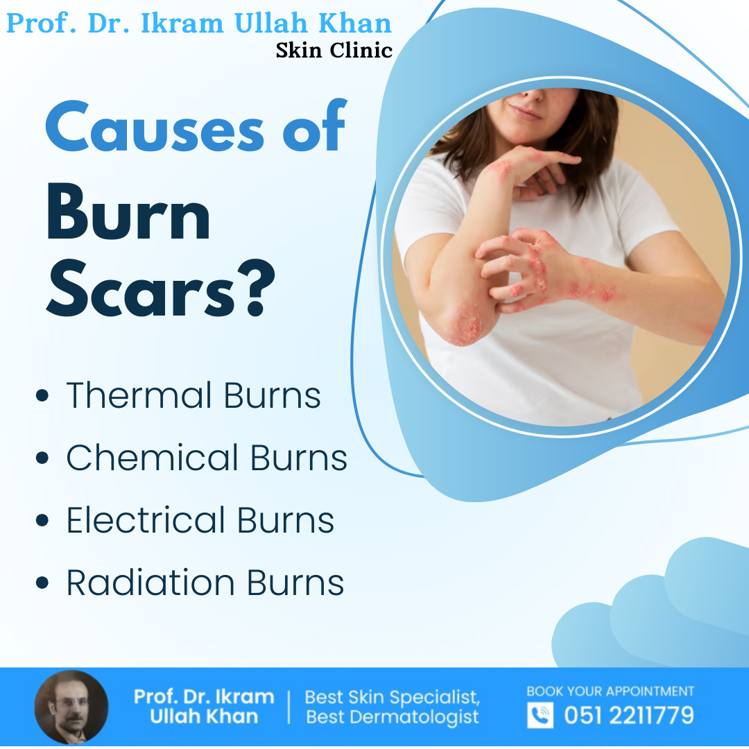 causes-of-burn-scars