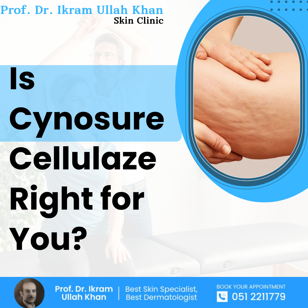 is-cynosure-cellulaze-right-for-you