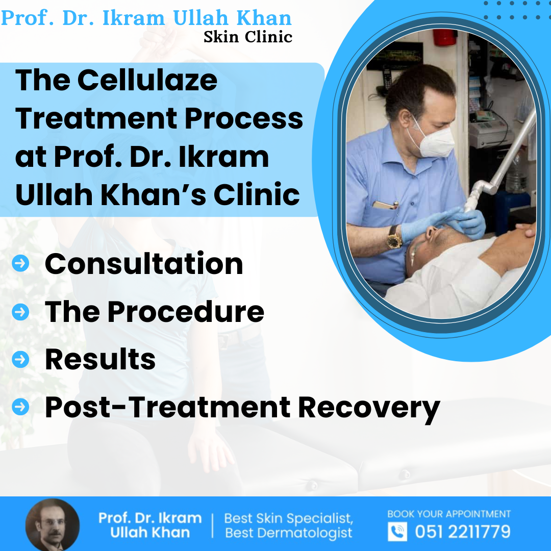 the-cellulaze-treatment-process-at-prof-dr-ikram-ullah-khan-clinic