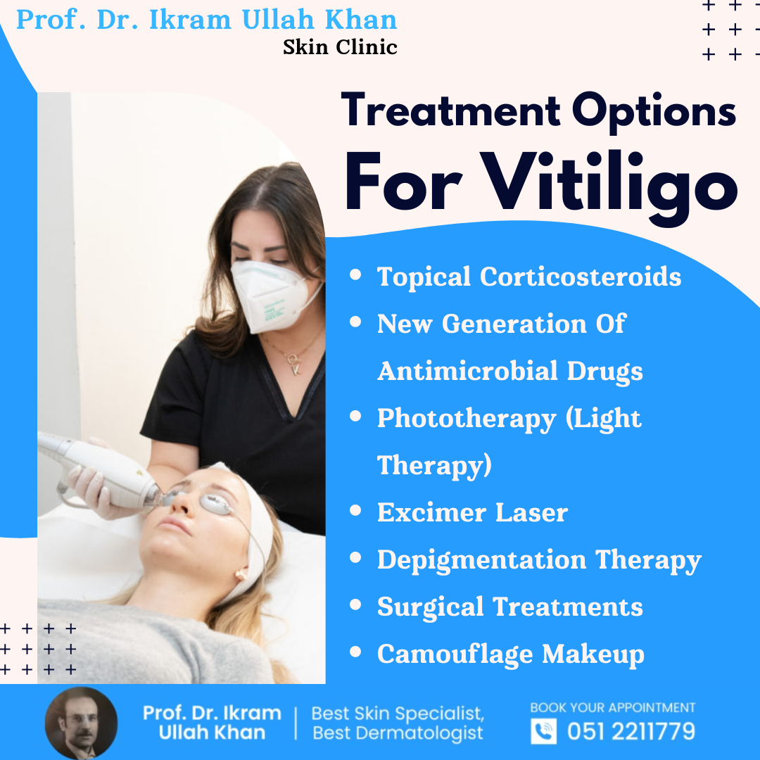 treatment-options-for-vitiligo