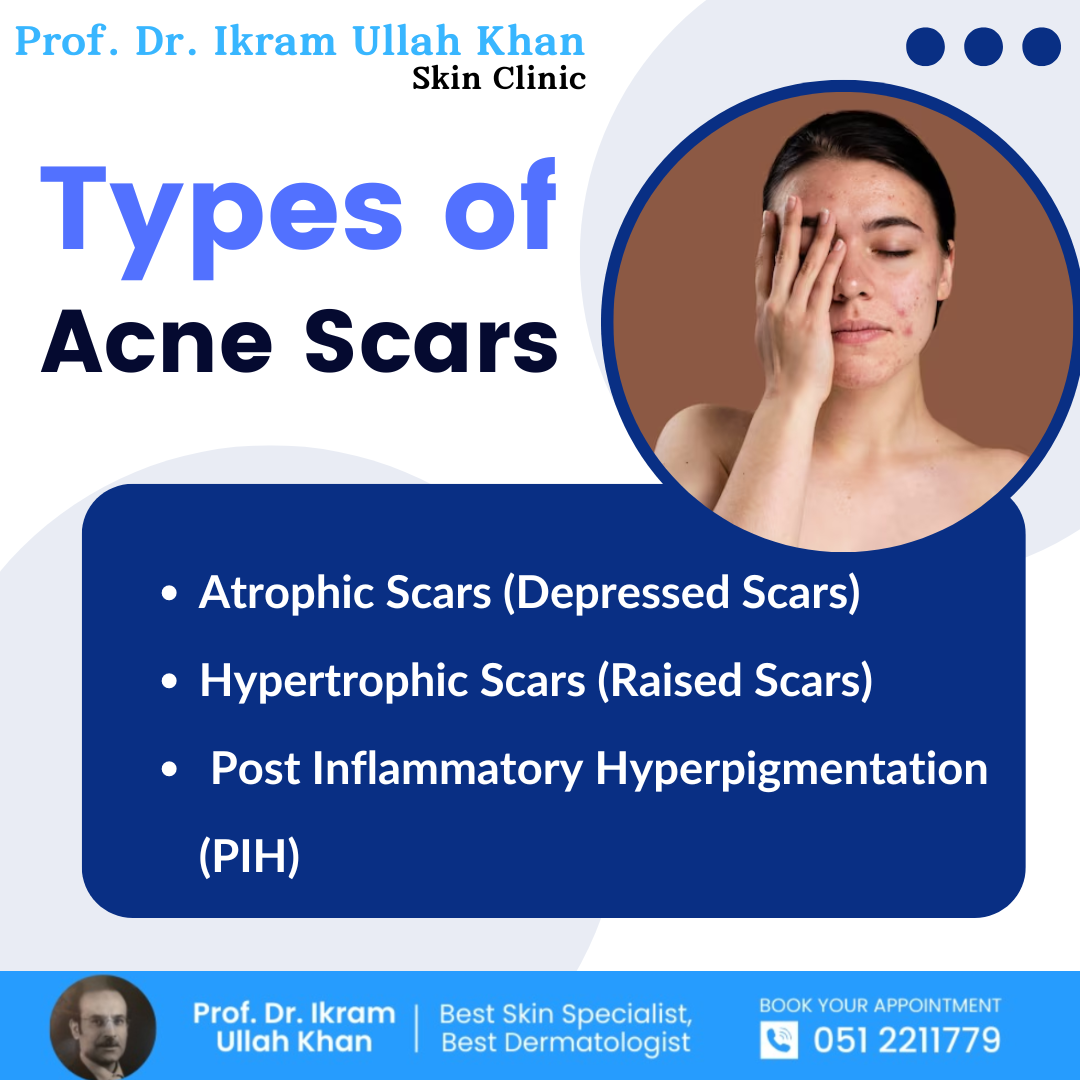 types-of-ance-scars