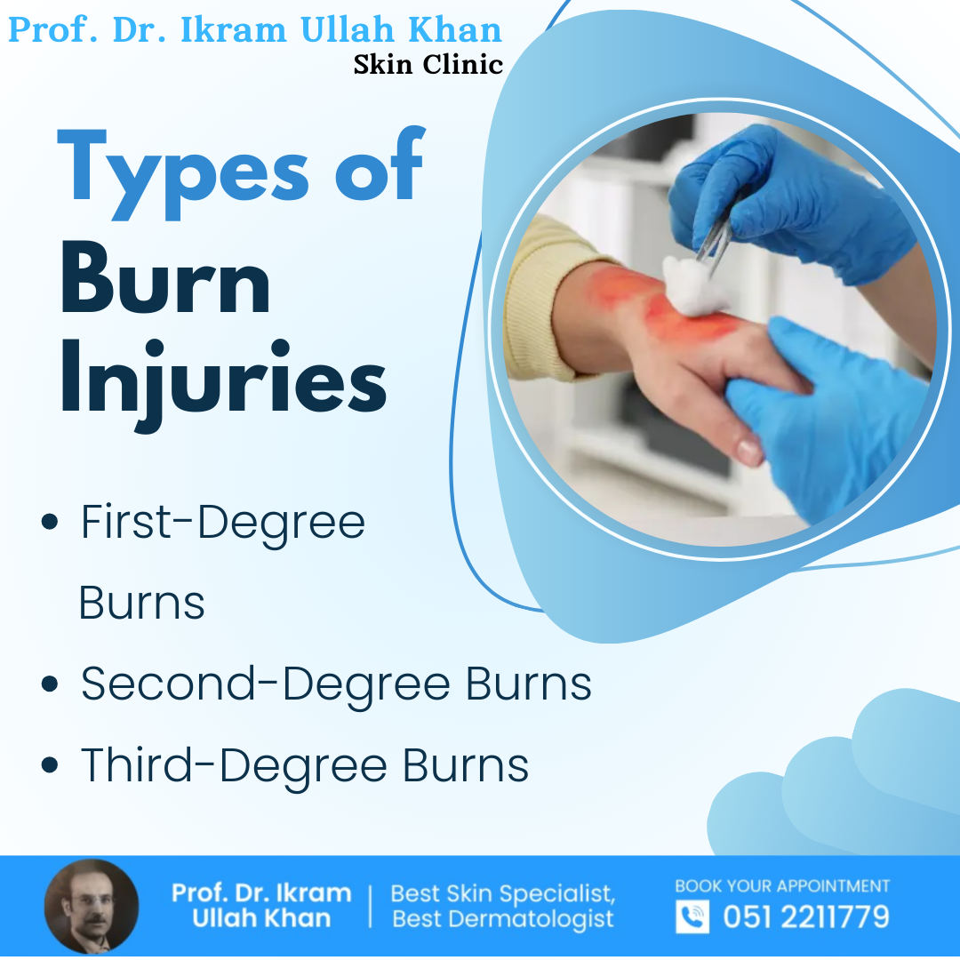 types-of-burn-injuries