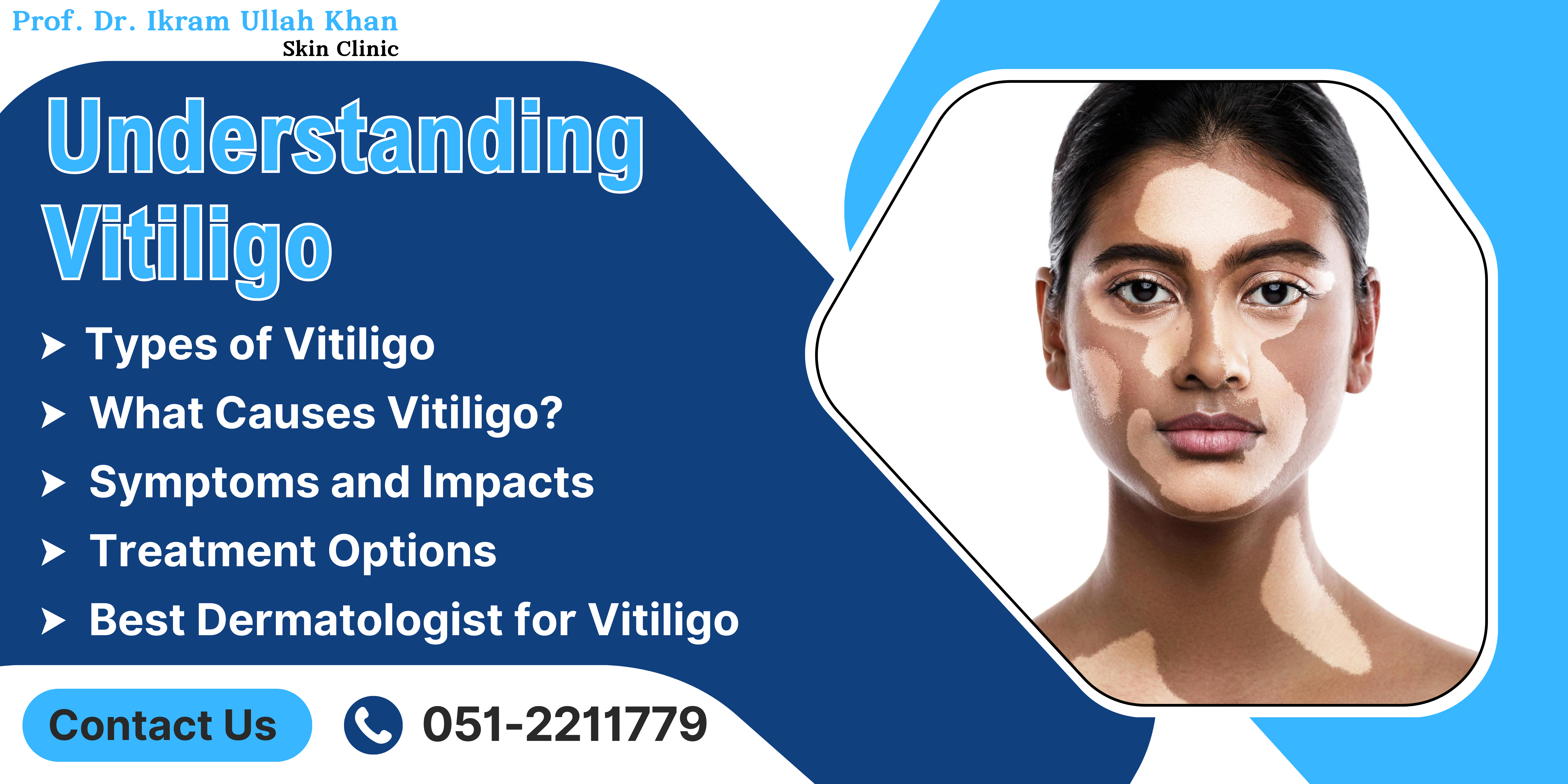 Vitiligo: Understanding Treatment Options for Restoring Skin Tone