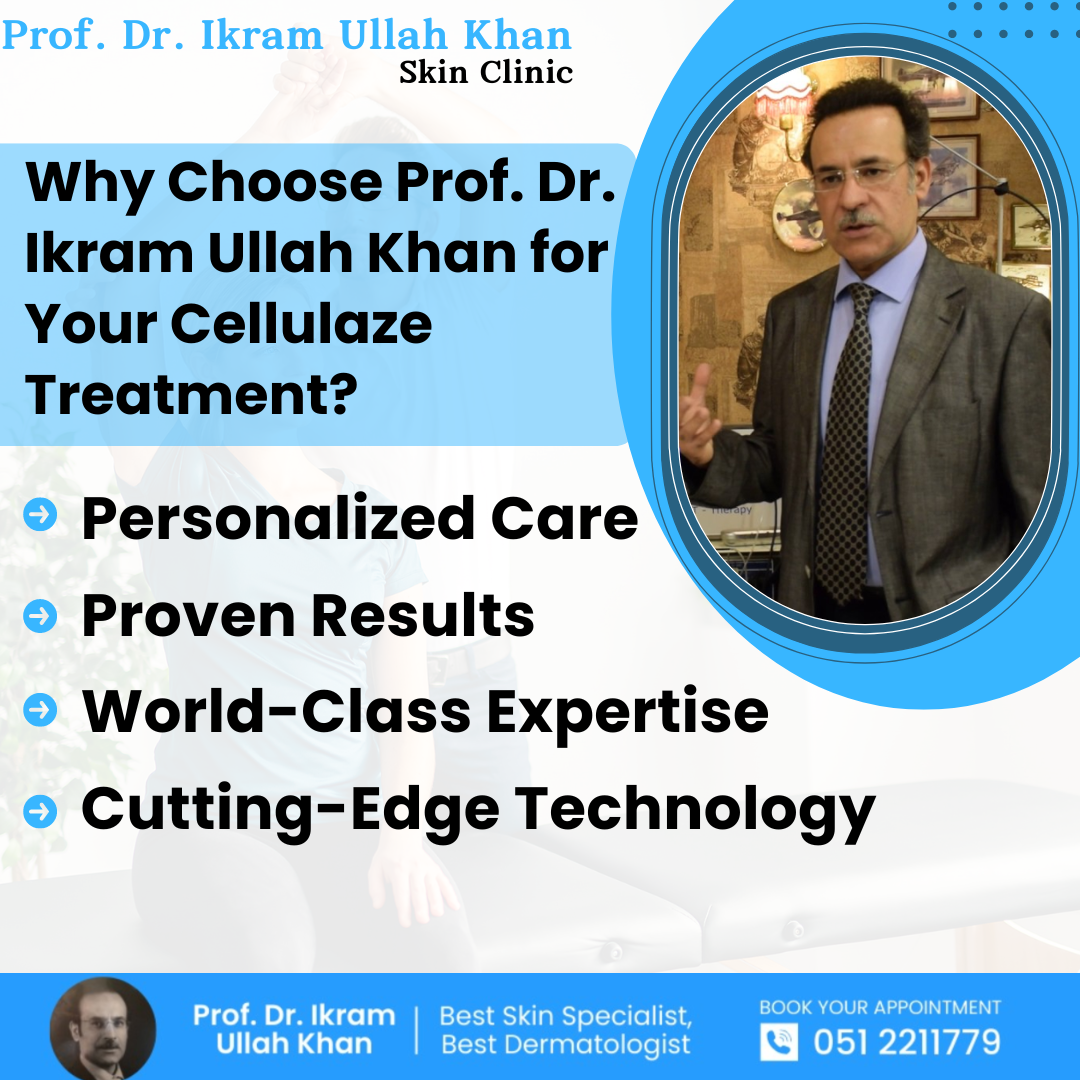 why-choose-prof-dr-ikram-ullah-khan-for-your-cellulaze-treatment