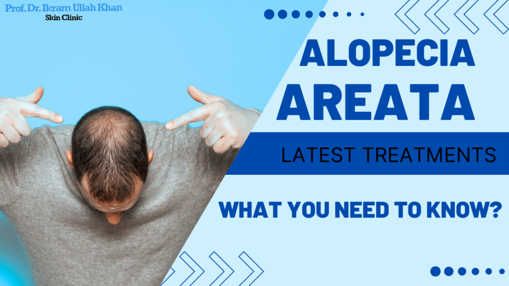 The Latest Advances in Treating Alopecia Areata: What You Need to Know