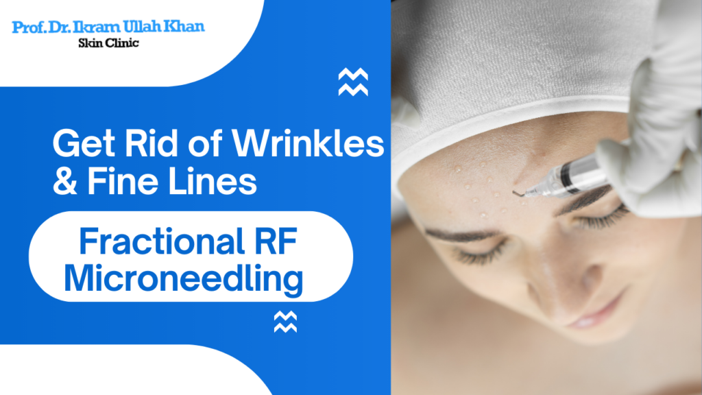 Get Rid of Wrinkles & Fine Lines with Fractional RF Microneedling