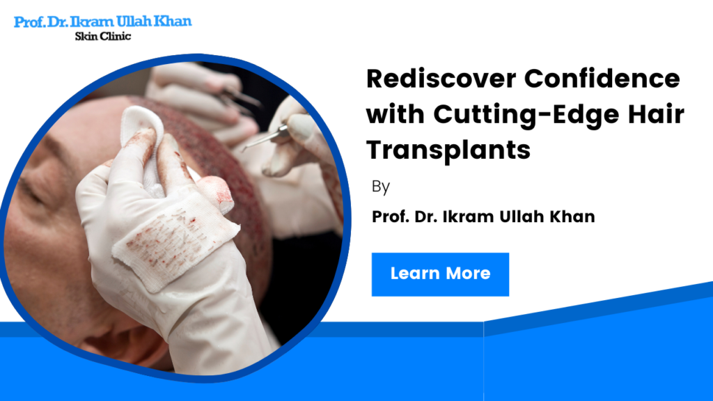 Rediscover Confidence with Cutting-Edge Hair Transplants by Prof. Dr. Ikram Ullah Khan