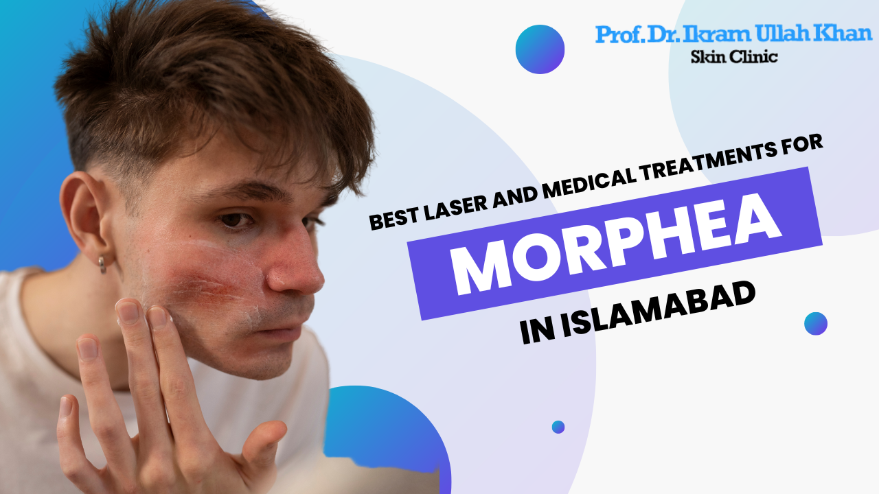 Best Laser and Medical Treatments for Morphea in Islamabad